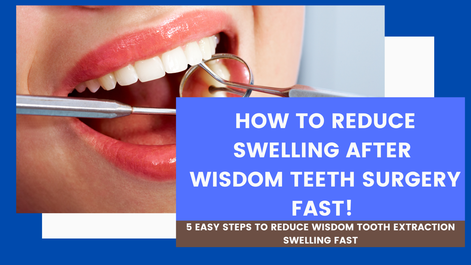 How to reduce swelling on wisdom teeth